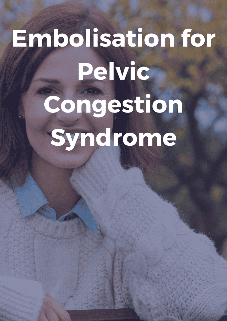 Pelvic congestion syndrome treatment