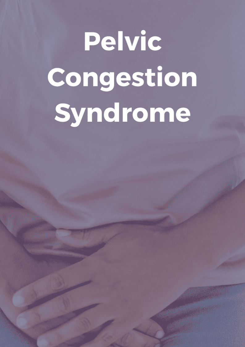 Pelvic congestion syndrome treatment