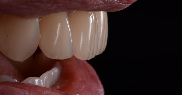 The predictable way of producing high quality dentures / BPS