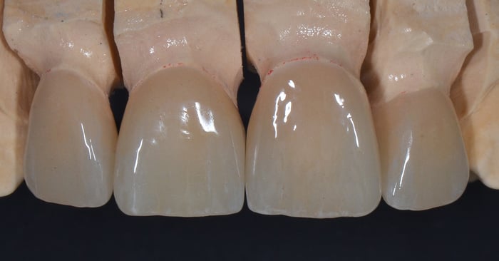 Staining skills can make a difference