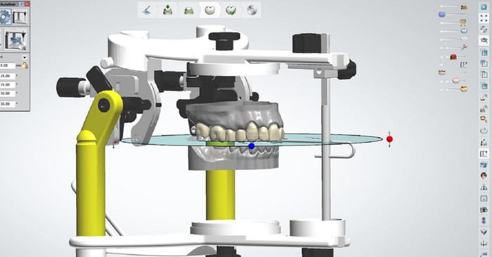 Synchronization of the physical and virtual articulator