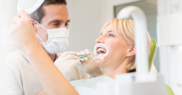 La preparazione dentale per le faccette in ceramica
