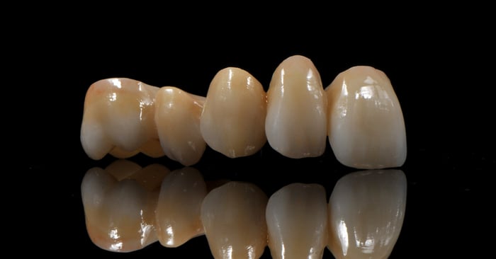 All Ceramic Options in Dentistry