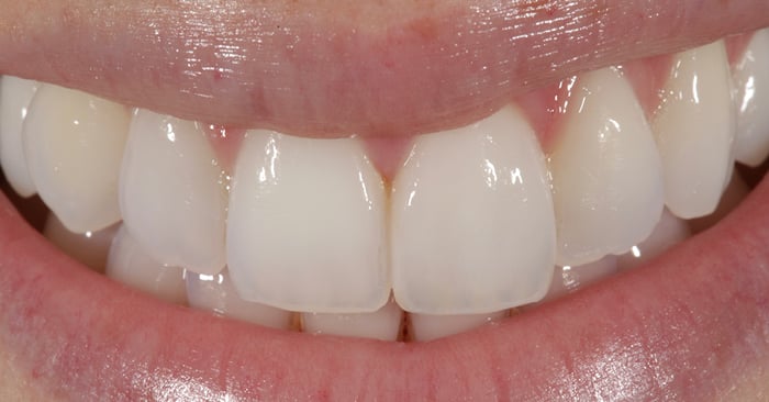 Les éléments essentiels d'un beau sourire
