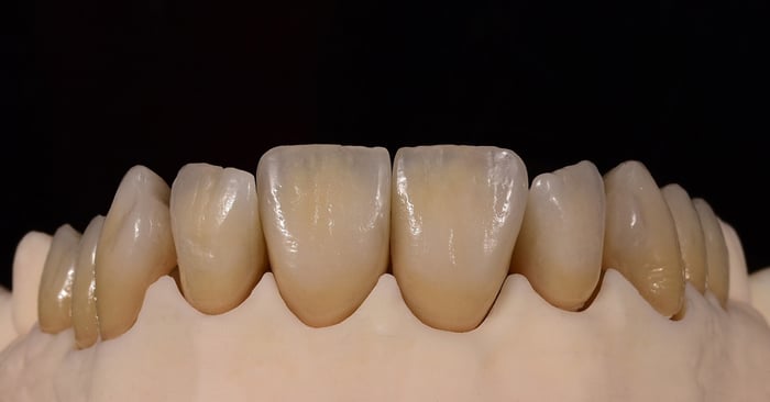 Questi 3 argomenti hanno interessato maggiormente gli odontotecnici nel 2020