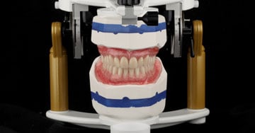 Denti su impianti preconfezionati per tutti i casi clinici