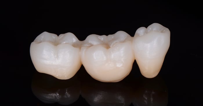 Test d'une nouvelle génération de matériaux tout céramique