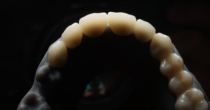 Dentistry Down Under: Digital Case Control and Versatility. Part 3