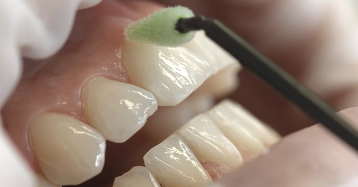 Modern oral health management