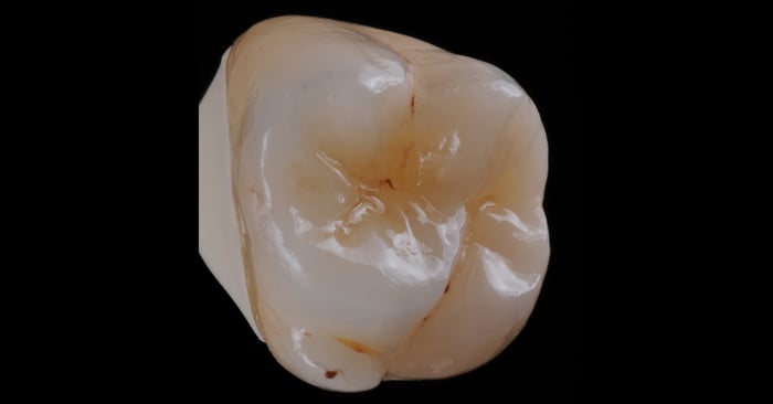 IPS e.max CAD Basic Stain & Glaze Technique Virtual Workshop