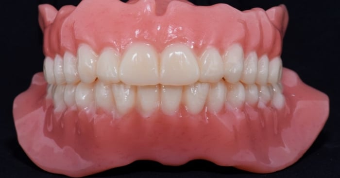 How to give your digital dentures an individual touch