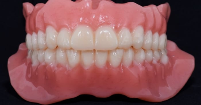 How to give your digital dentures an individual touch