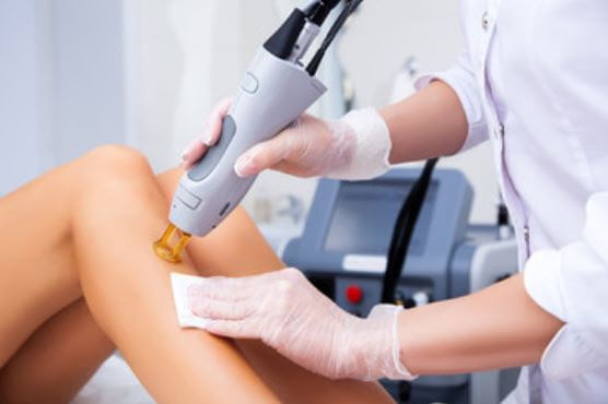 Is Laser Hair Removal Truly Permanent?