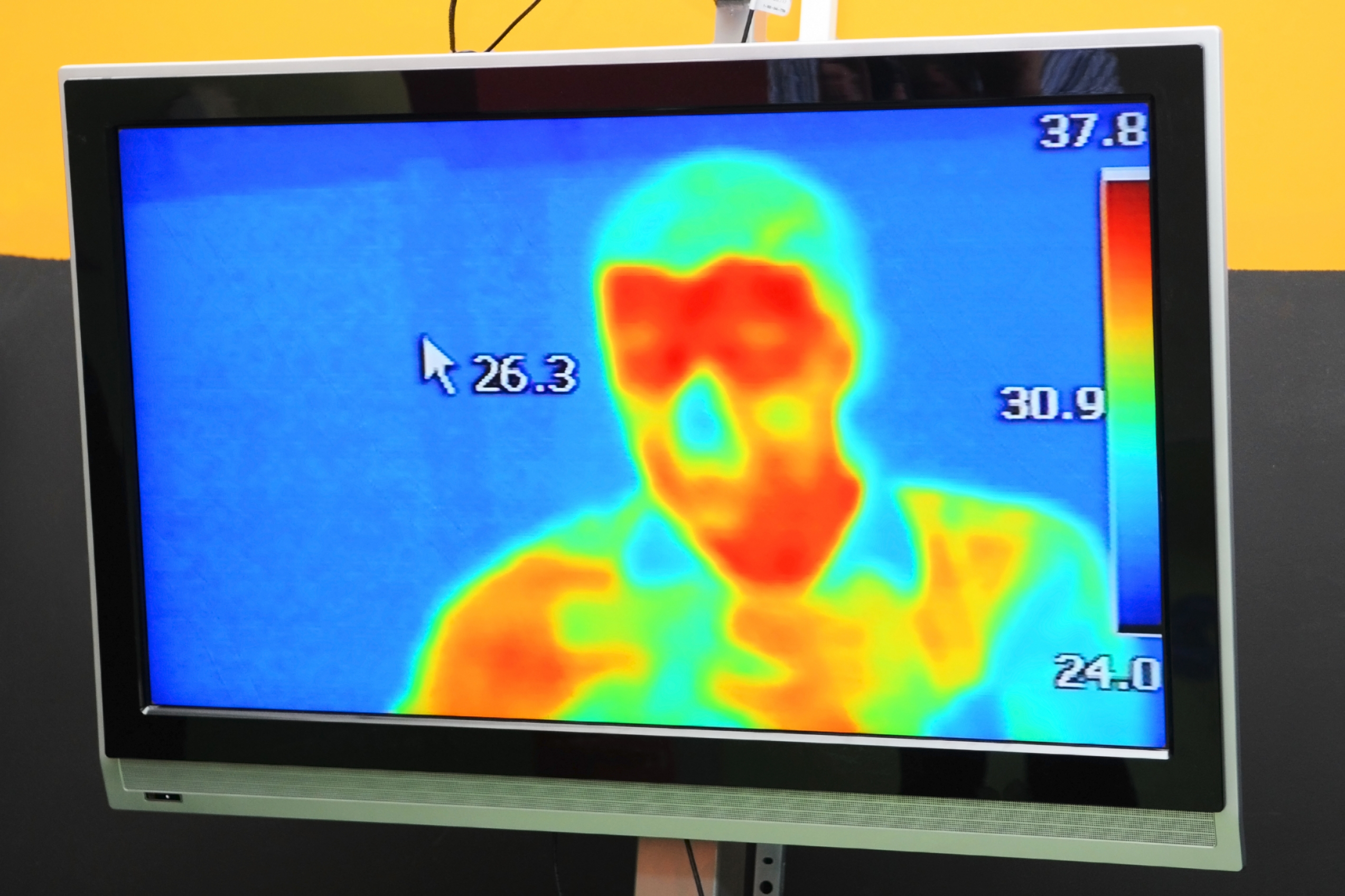 Thermal Cameras at UCLA Medical Buildings Quickly Scan for Fever to Improve  Safety