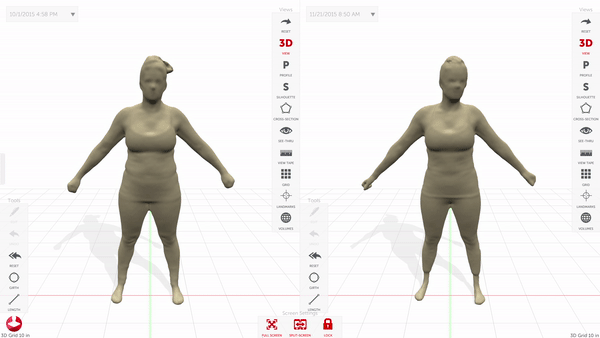 Split Screen rotation + profile-2