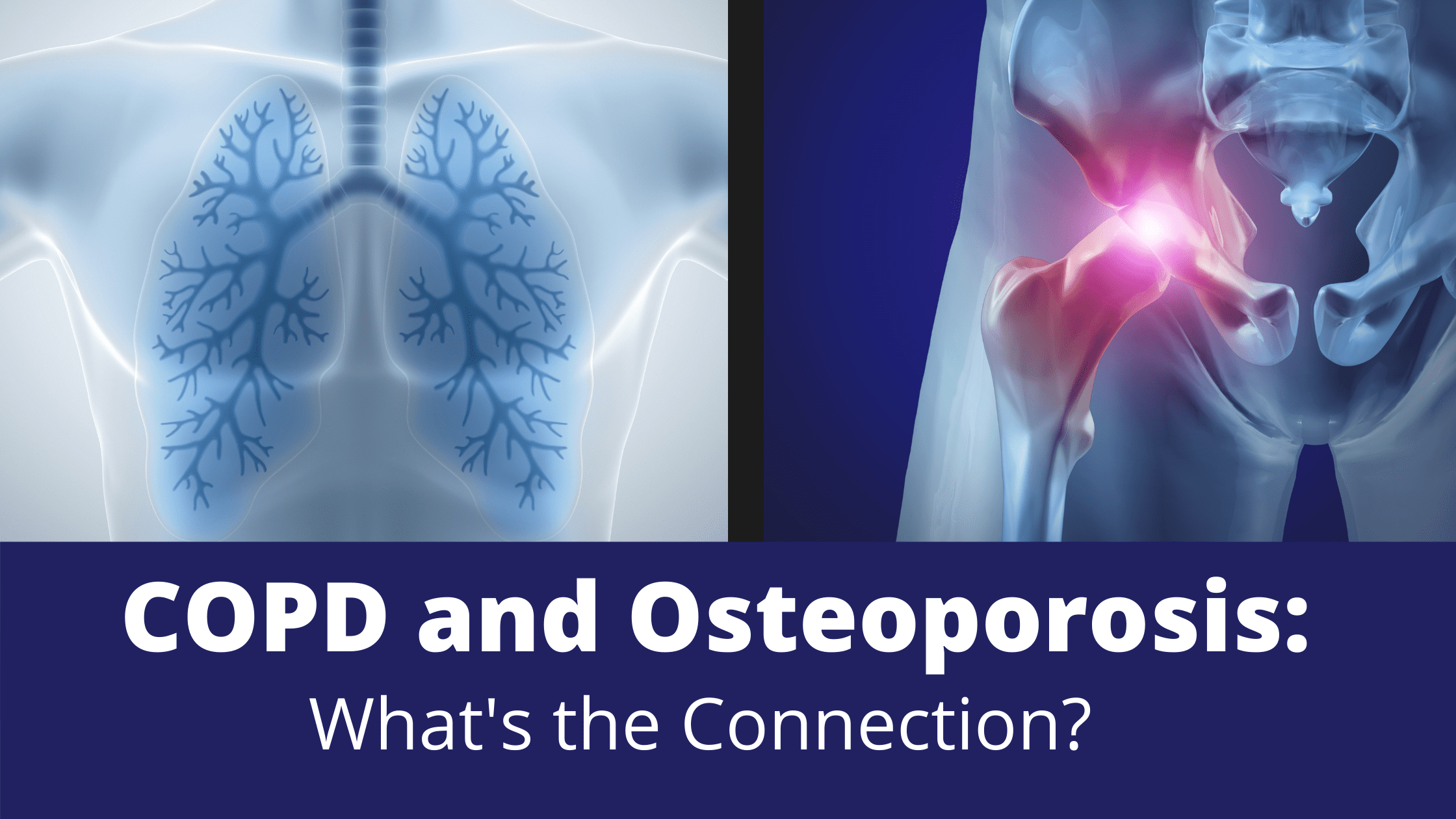 COPD and Osteoporosis