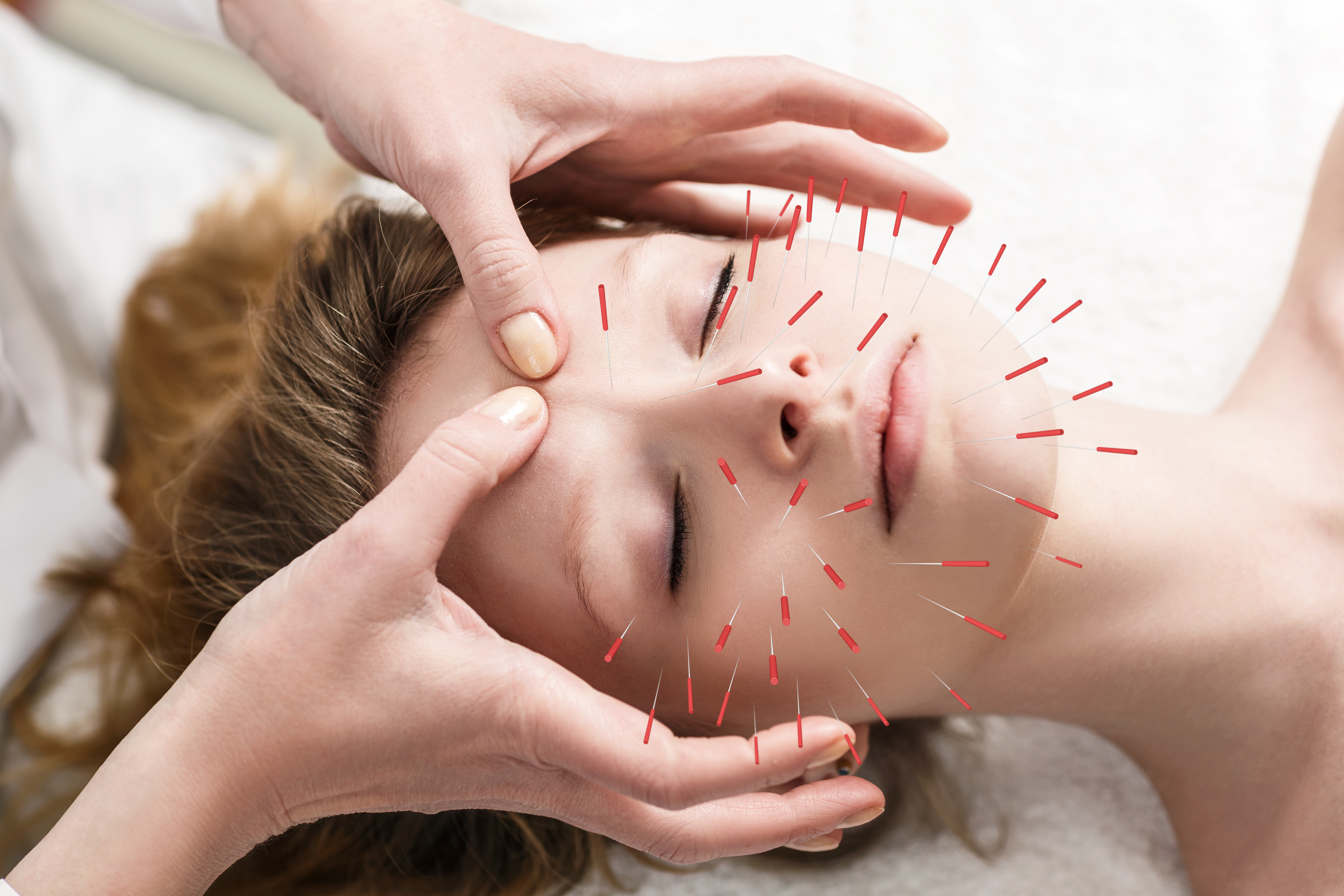 Why Acupuncture Is Effective for Restoring Your Skin’s Youthful Glow-2