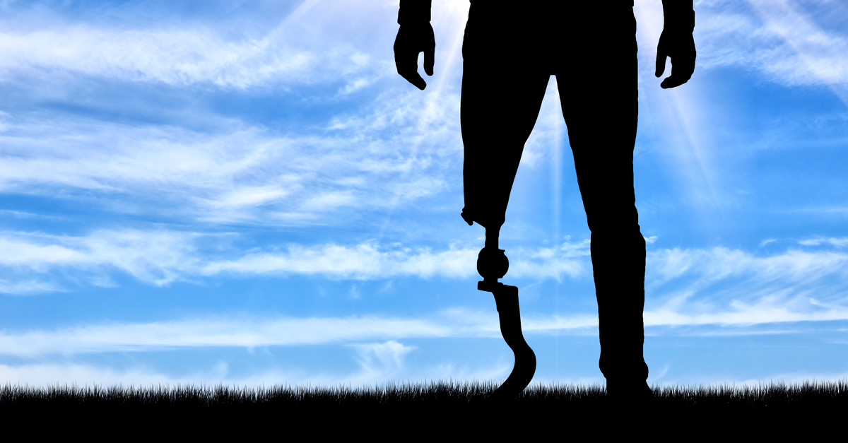Walking With a Prosthetic Limb - Prosthetic Step Training