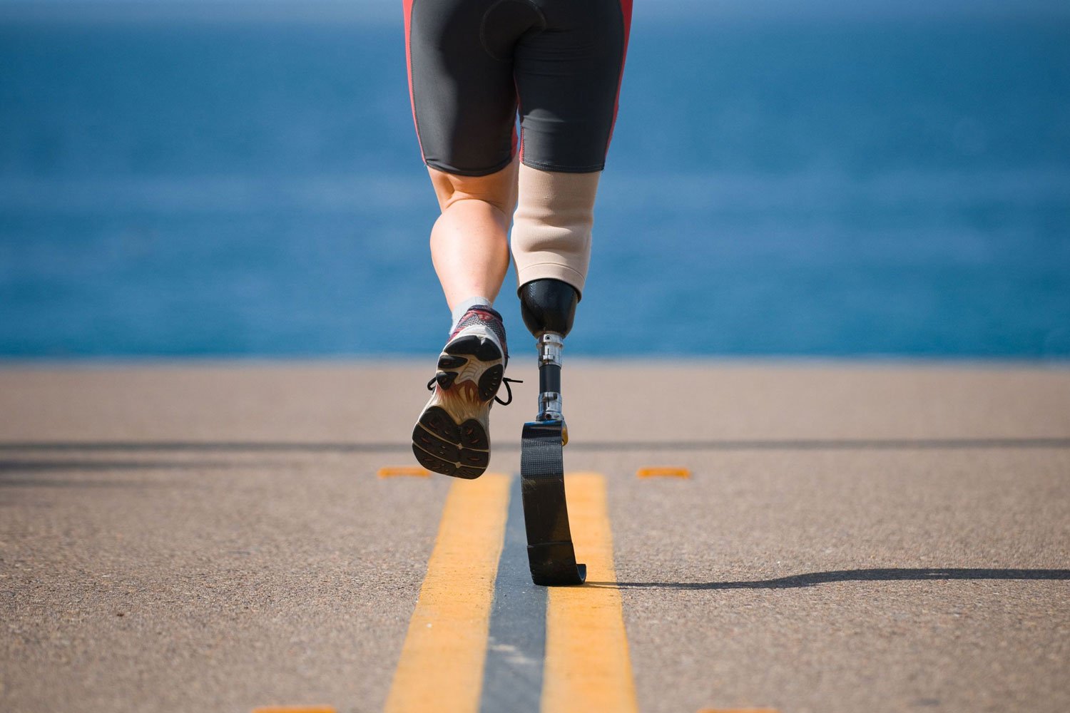 What You Should Know Before Getting a Prosthetic Leg