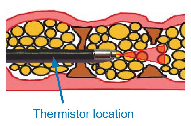 thermistor-cosmetic-laser-surgery thermistor-cosmetic-laser-surgery